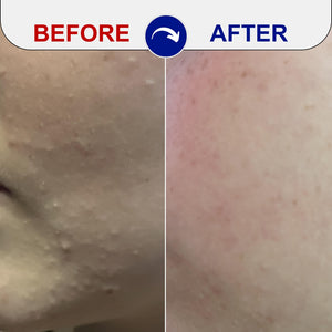 Before and After Image of user using the EMUAID® Clear + Repair