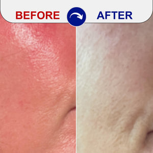 Before and After Image of user using the EMUAID® Clear + Repair